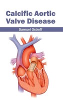 Samuel Ostroff | Calcific Aortic Valve Disease | Buch | Englisch (2015)