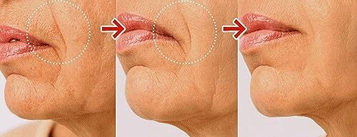WHITESILK〔Derma〕― Retinaldehyde(Liposome) 0.1 Complex EXPERT Strength Rapid C... - Picture 4 of 7