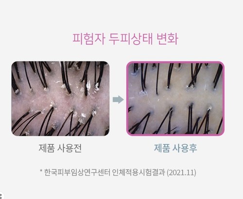 Seo Rin Hair Conditioner 8ml x 15pcs Healthy Scalp Care Refreshing Conditioner - Picture 4 of 4