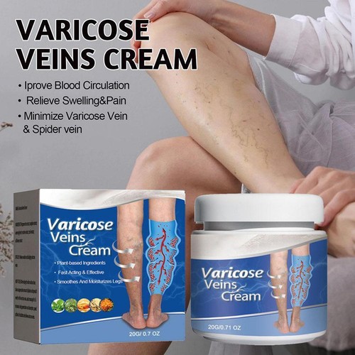 Crema para eliminar venas Cremevital crema varicosas pasta para aliviar venas, mejorar Circu G7J8 63SH - Imagen 4 de 15