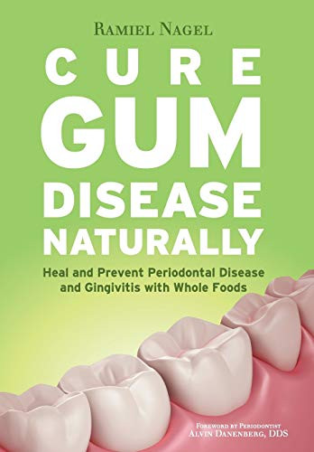 Cure Gum Disease Naturally: Heal Gingivitis and Periodontal Disease with Whole - Image 4