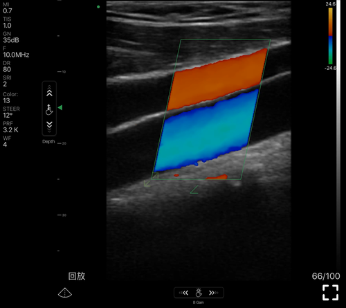 Wifi Color Doppler 128 Elemente 3 in 1 Konvex/Linear/Herzunterstützung Android iOS - Bild 8 von 15