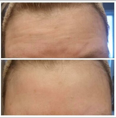 Nuskin ageLOC Galvanic Spa Facial Gels for Anti-Ageing Device Set