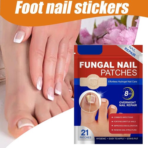 * Nagelpilzpflaster Fußnagelpflege Nagelreparatur über Nacht NEU - Bild 5 von 8