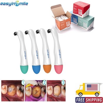 10/50PcDental Pro Matrix Bands Preformed Metal Matrices Adjust Molar Band 4.5/6