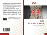 Les Tumeurs De La Vessie Joseph Ngandu
