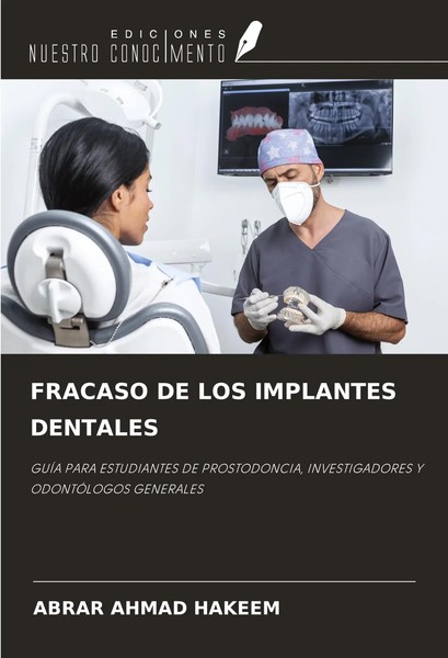Abrar Ahmad Hakeem | Fracaso DE LOS Implantes Dentales | Taschenbuch | Spanisch-image