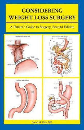 Thumbnail - Considering Weight Loss Surgery: A Patient's Guide To Surgery By Glenn