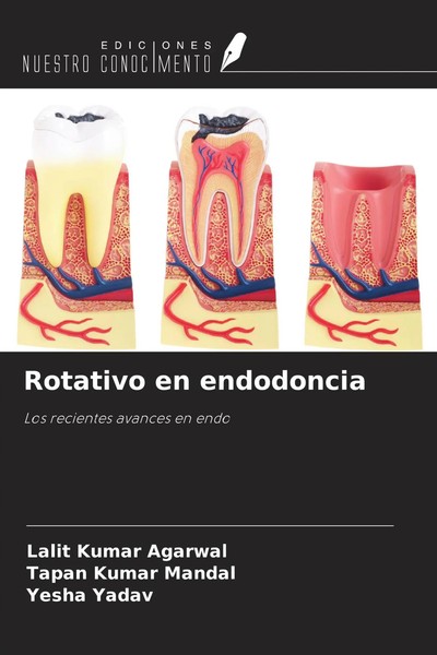 Lalit Kumar Agarwal (U. A.) | Rotativo En Endodoncia | Taschenbuch | Spanisch-image