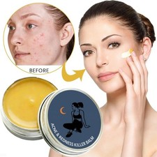 Acne Redness Killer Norse Naturals Acne Balm Ultra-Performance Skincare Formula