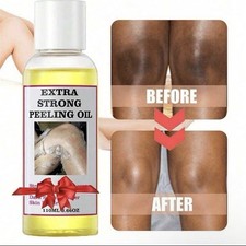 Extra Strong Peeling Oil Body Skin Brightening Exfoliating Peel Off Remover110ml