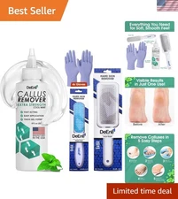 Luxury Callus Removal Kit: DeEnti Mint Foot Rasp, File & Gloves - Spa Quality