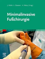 Minimalinvasive Fußchirurgie Jörn Dohle (u....