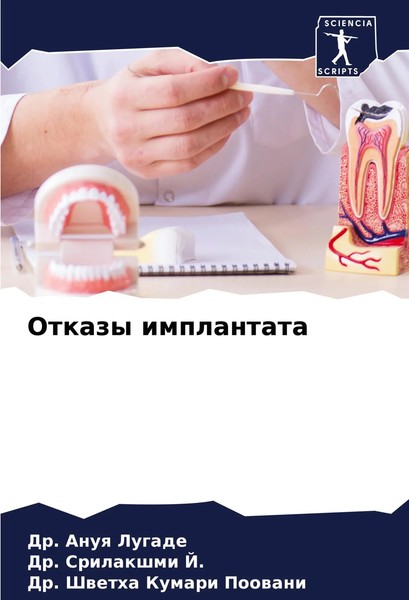 Otkazy Implantata Anuq Lugade (U. A.) Taschenbuch Russisch 2024 Sciencia Scripts-image
