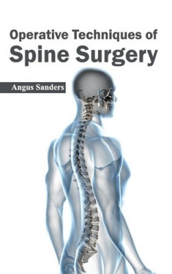 Operative Techniken der Wirbelsäulenchirurgie von Angus Sanders [gebunden]