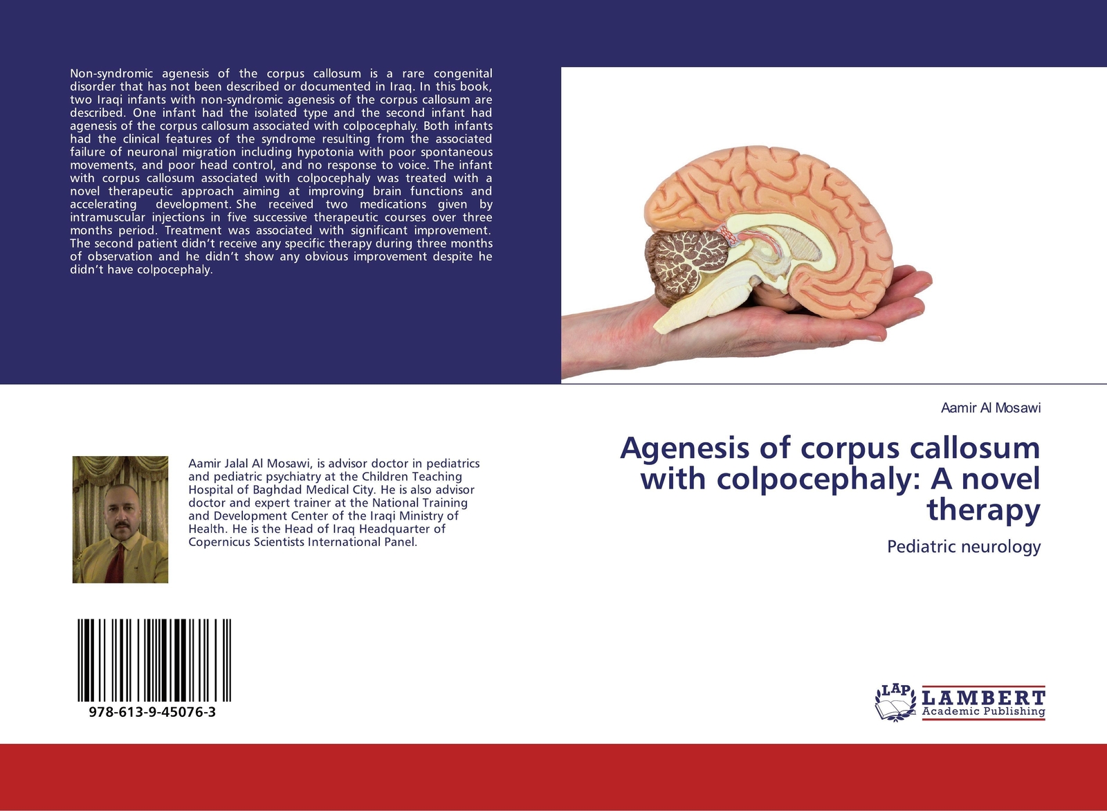 Agenesis Of Corpus Callosum With Colpocephaly: A Novel Therapy | Aamir