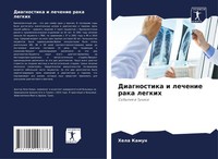 Hela Kamun | Diagnostika I Lechenie Raka Legkih | Taschenbuch | Russisch (2021)