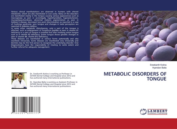 Sreekanth Kotina (U. A.) | Metabolic Disorders OF Tongue | Taschenbuch (2024)-image