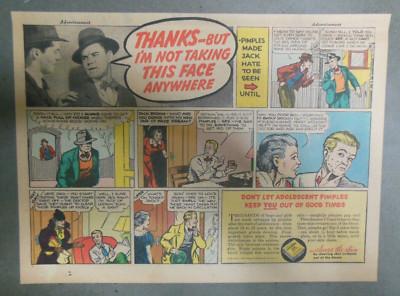 Fleischmann's Yeast Ad: This Face Isn't Going Anywhere !  (Pimples) 1930's