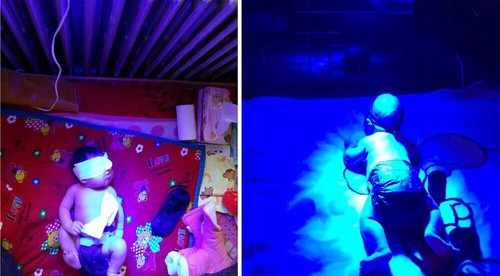 Gelbsucht Lichttherapie Neugeborene Bilirubin Lampe Blaulicht Decke Abdeckung 144 LED - Bild 16 von 20