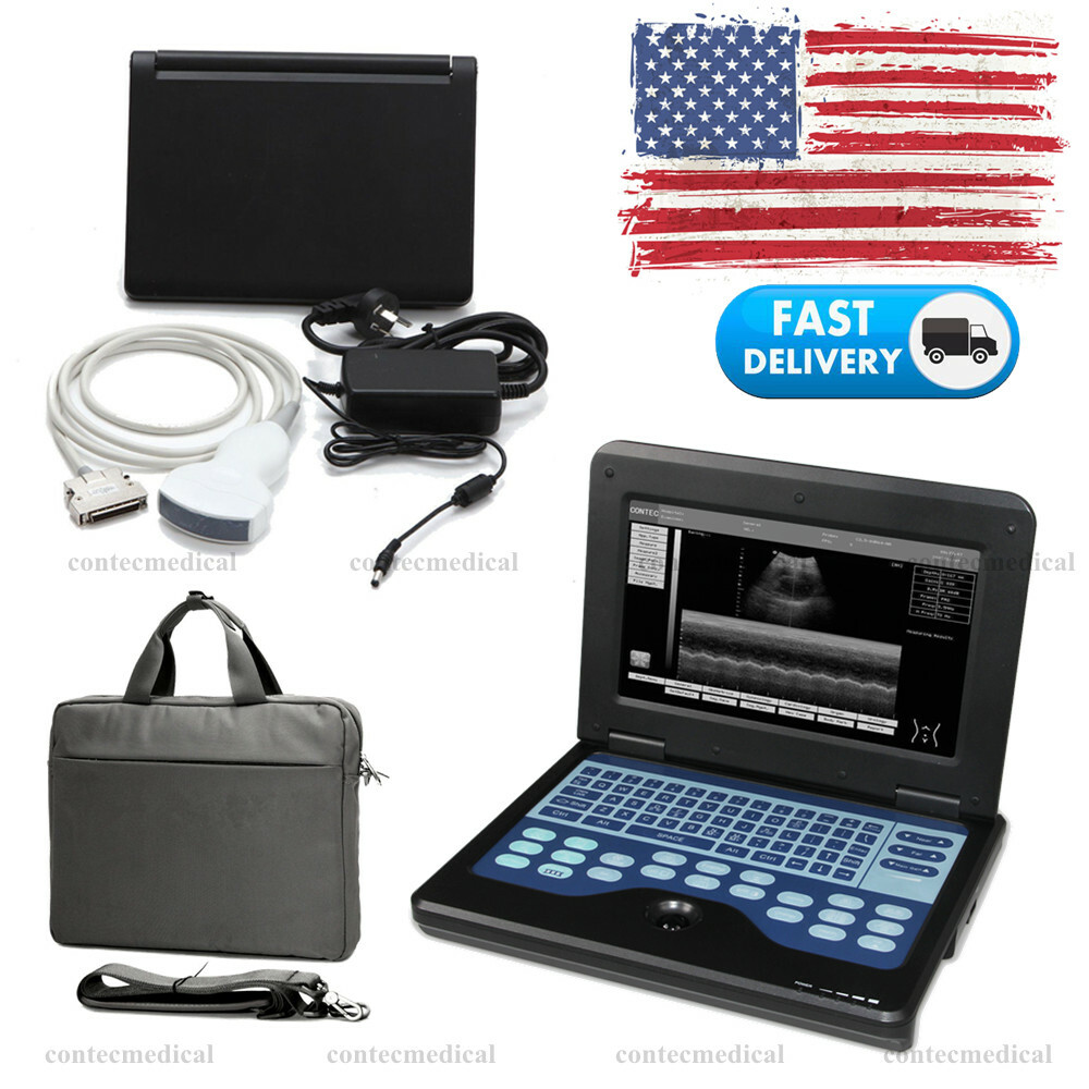 USA Portable Ultrasound Scanner Diagnostic Convex Probe escáner de ultrasonido 