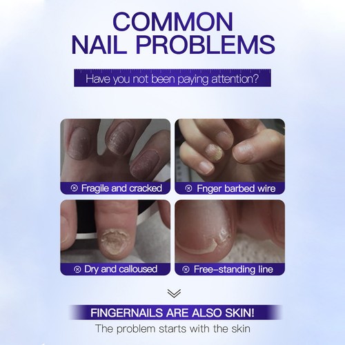 1Pz Nail Care Essence Siero Nutrimento Profondo Forza Cura Unghie Essenza - Foto 10 di 12
