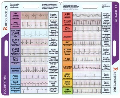 EKG Rhythm Interpretation - Compact & Portable Reference Card   Rapid Interpr...