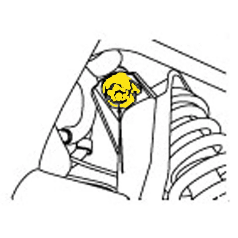 Rueda de alineación delantera MOOG / Kit de inclinación para Lincoln Aviator 2003-2005 Foto 3 de 4