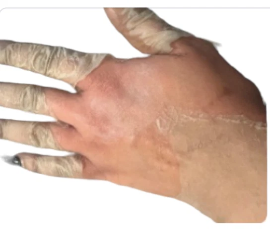 Yellow peeling oil  Extra strength - Image 2 of 4