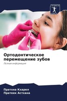 Prathna Kharel (U. A.) | Ortodonticheskoe Peremeschenie Zubow | Taschenbuch