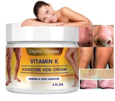 Varicose cream natural vein leg support spider Vitamin K