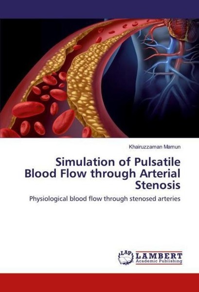 Simulation Of Pulsatile Blood Flow Through Arterial Stenosis Khairuzzaman Mamun-image