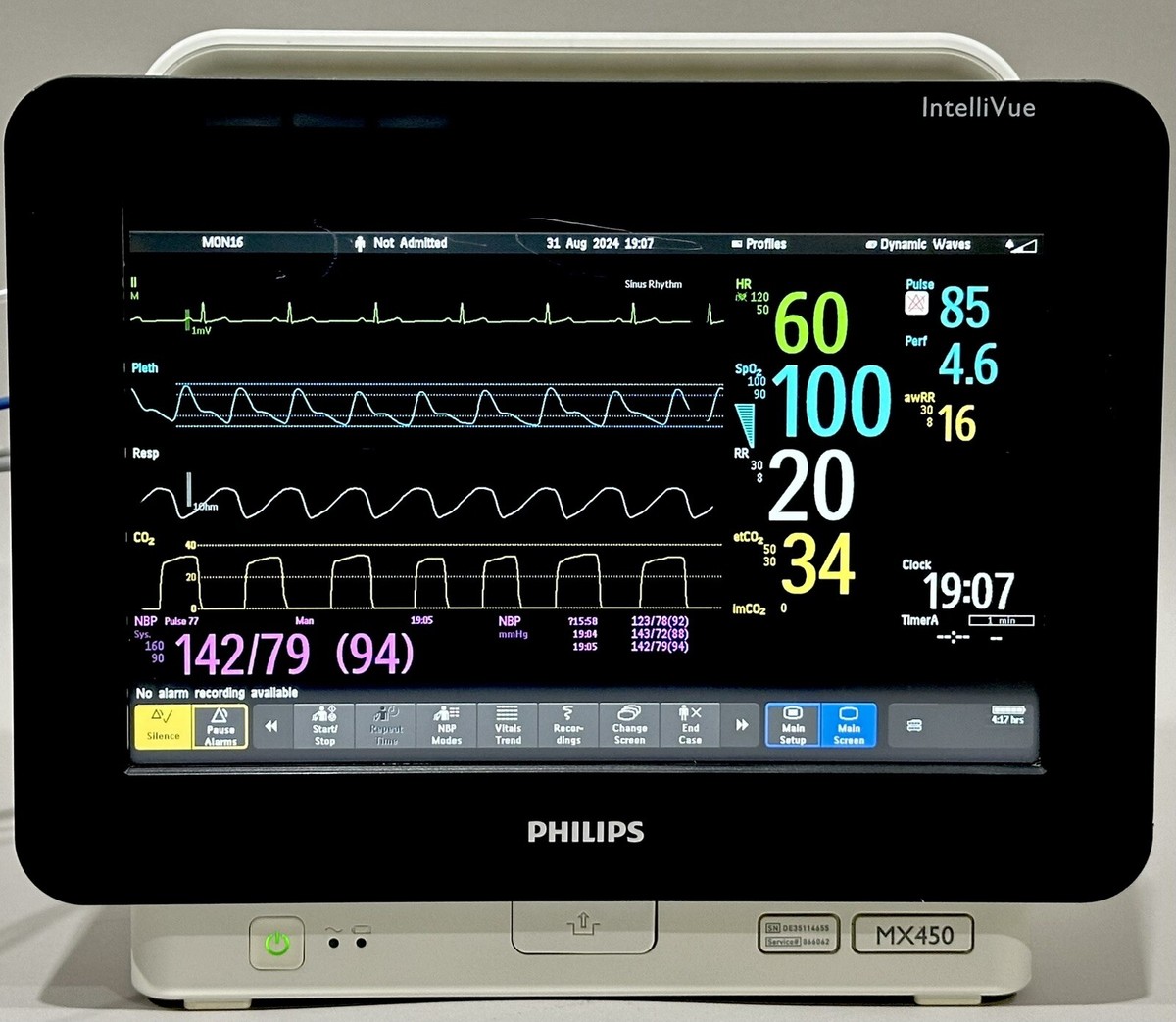 PHILIPS INTELLIVUE MX450 866062 CO2 MONITOR WITH 867036 MMX
