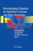 Neuroimaging Diagnosis For Alzheimer's Disease And Other Dementias Hiroshi Matsu