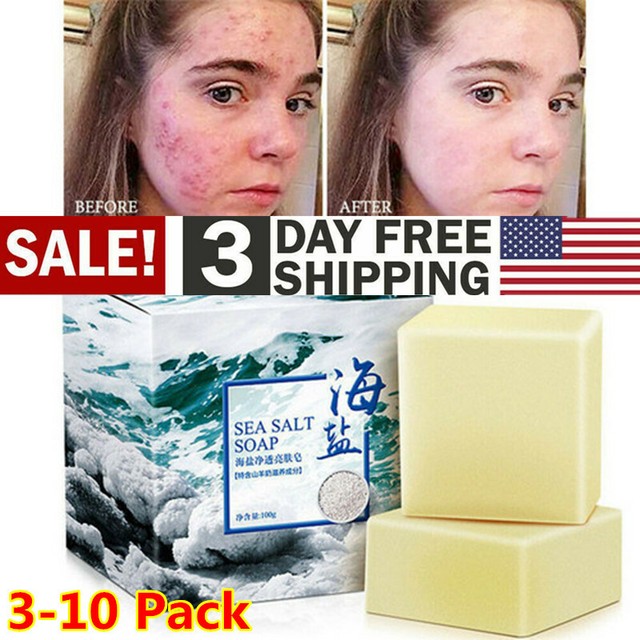 sea salt soap for acne