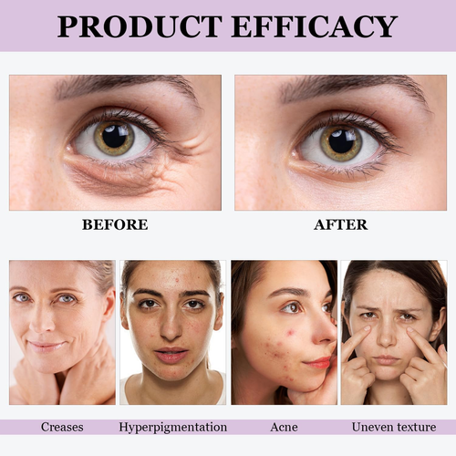 2 PEZZI Bakuchiol Retinol Serum - Cura del viso coreano anti-età per rughe e bagliori - Foto 6 di 12