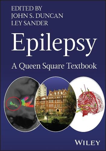 Epilepsy: A Queen Square Textbook - Image 2