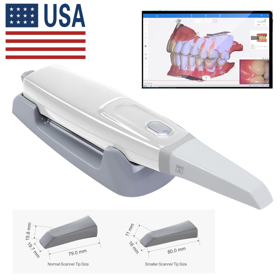 Updated Dental Intra-oral Scanner 3D Real-time Display Software w ...