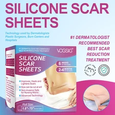 Scar Removal Silicone Tape for Hypertrophic Scars & Keloids, 1.6'' x 60''-150"