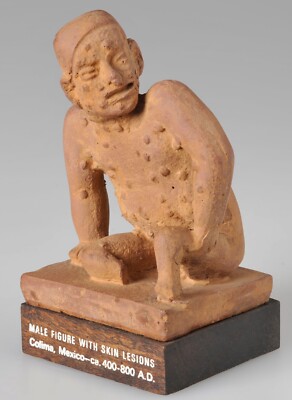 Vintage Schering Pharmaceutical Valisone Advertising Male Figure w Skin Lesions