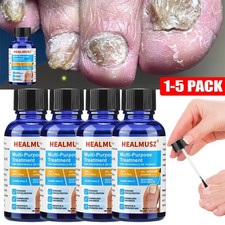 1-5 Pack Anti Fungal Nail Treatment Toenail Fungus Fungi Nail Repair Foot Care