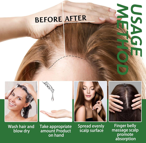 Olio Di Rosmarino per Capelli, Rosemary Essential Oil for Hair Growth, Puro Olio - Foto 7 di 12
