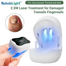 Professional Nail Fungus Laser 910nm/470nm Phototherapy Treatment Device Home