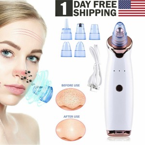 face pore sucker