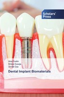 Hiral Parikh (U. A.) | Dental Implant Biomaterials | Taschenbuch | Englisch