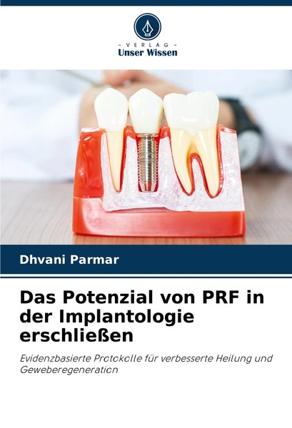Dhvani Parmar | Das Potenzial Von Prf In Der Implantologie ErschließEn | Buch-image