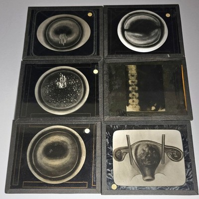 1930s Pathology Glass Slides X-Ray Anatomy Histology Pathology Cells Bones 154