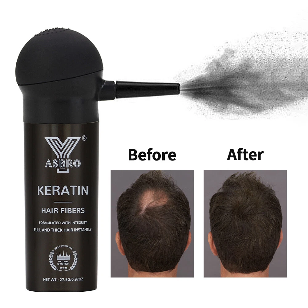 Share more than 152 hair fibers side effects tnbvietnam.edu.vn