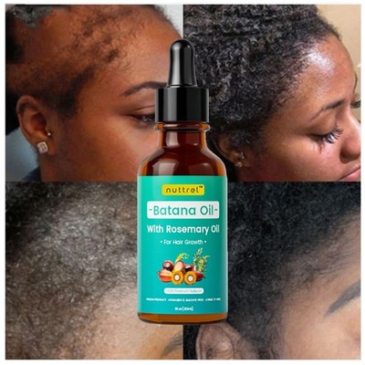 Natural Batana Oil For Hair Growth Healthier Thicker Fuller Anti Hair Loss 30ML