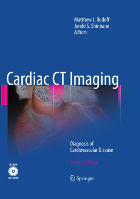 Cardiac CT Imaging: Diagnosis of Cardiovascular Disease 2nd Edition